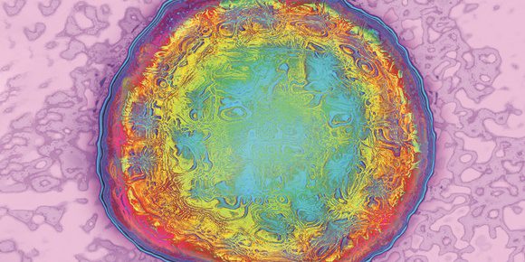 1073602_hepatitis-b-virus-tem-spl-17