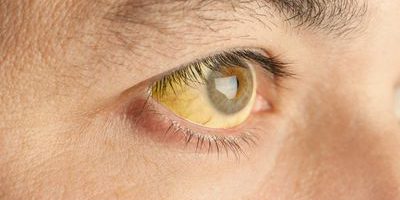 GettyImages-155599928-58fd9b185f9b581d5947ac17