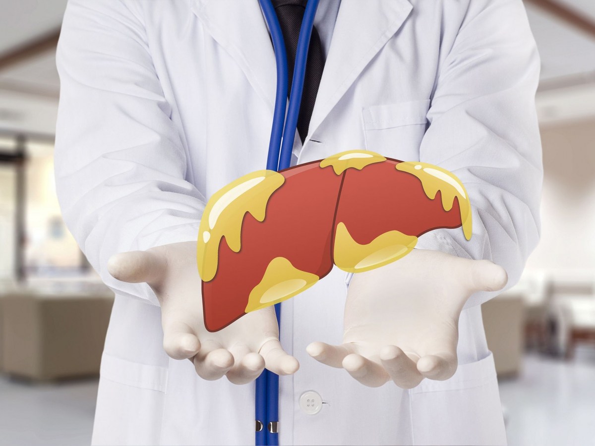 a8354ff0-lipos-sto-sukoti