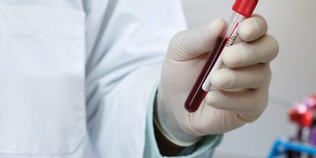 h_dx_tube_hand_close_01_4-3-03468854_9