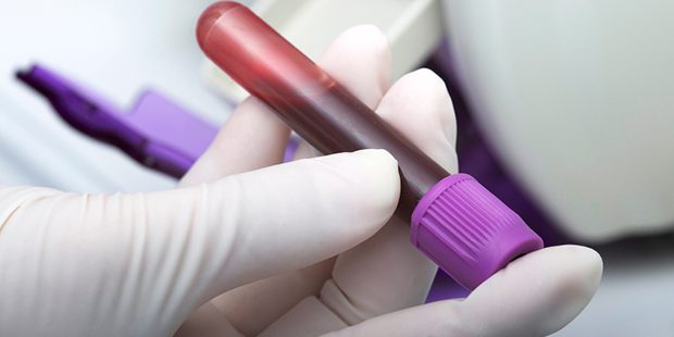 iStock_000048228056_Small-20160225124553979