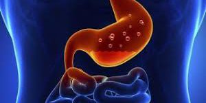 αρχείο-λήψης11