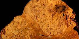 αρχείο-λήψης28